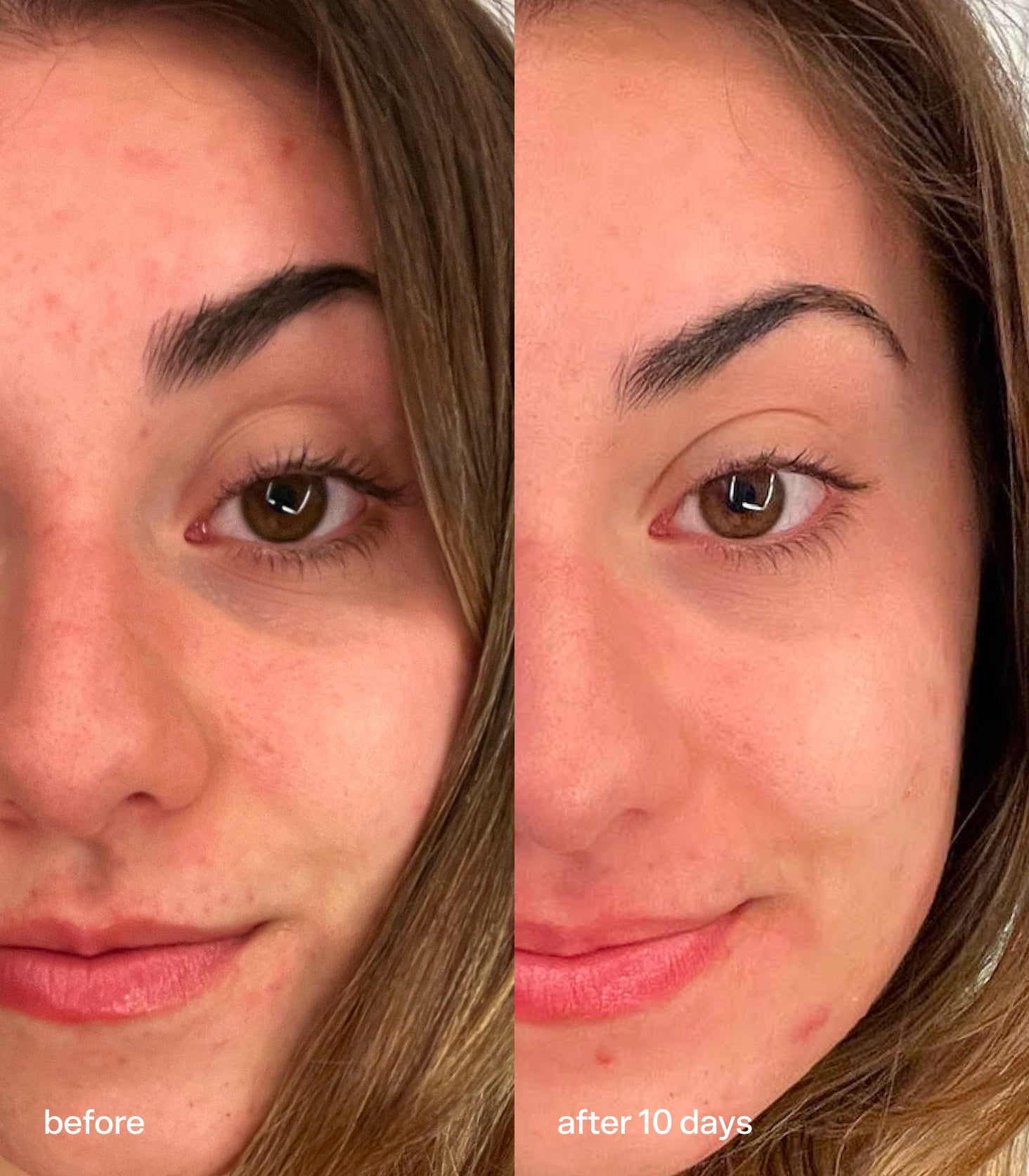 Morning Rays - Image 3